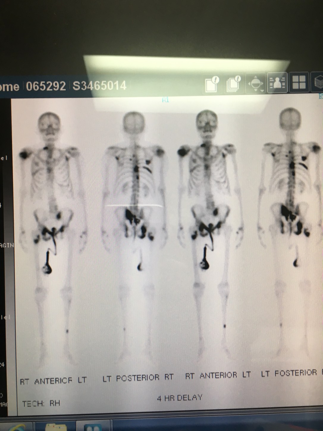 20170901_172357871_iOS